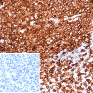 Formalin-fixed, paraffin-embedded human tonsil stained with HLA-DR Recombinant Rabbit Monoclonal Antibody (HLA-DRA/6839R). Inset: PBS instead of primary antibody; secondary only negative control.
