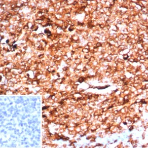 Formalin-fixed, paraffin-embedded human tonsil stained with HLA-DR Recombinant Rabbit Monoclonal Antibody (HLA-DRA/6840R). Inset: PBS instead of primary antibody; secondary only negative control.