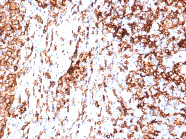 Formalin-fixed, paraffin-embedded human tonsil stained with HLA-DR Recombinant Rabbit Monoclonal Antibody (HLA-DRA/6840R). HIER: Tris/EDTA, pH9.0, 45min. 2°C: HRP-polymer, 30min. DAB, 5min.