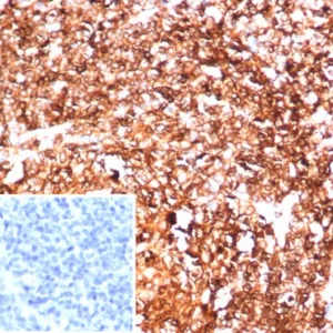 Formalin-fixed, paraffin-embedded human tonsil stained with HLA-DR Recombinant Rabbit Monoclonal Antibody (HLA-DRA/6844R). Inset: PBS instead of primary antibody; secondary only negative control