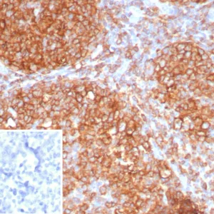 Formalin-fixed, paraffin-embedded human tonsil stained with HLA-DR Recombinant Rabbit Monoclonal Antibody (HLA-DRA/8286R). Inset: PBS instead of primary antibody; secondary only negative control.