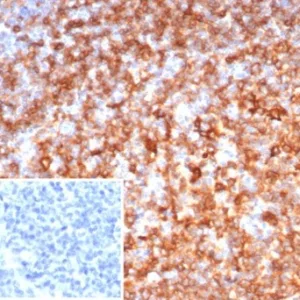Formalin-fixed, paraffin-embedded human tonsil stained with HLA-DR Monoclonal Antibody (rHLA-DRB/7198). Inset: PBS instead of primary antibody; secondary only negative control.