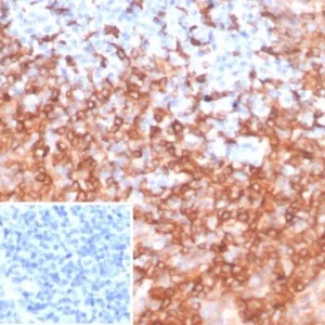 Formalin-fixed, paraffin-embedded human tonsil stained with HLA-DR Monoclonal Antibody (HLA-DRB/7058R). Inset: PBS instead of primary antibody; secondary only negative control.