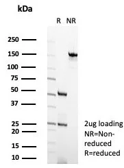 SDS-PAGE Analysis of Purified HLA-G Mouse Monoclonal Antibody (HLAG/7750). Confirmation of Purity and Integrity of Antibody.