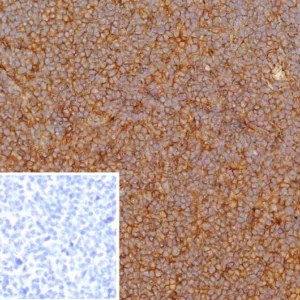 Formalin-fixed, paraffin-embedded human tonsil stained with HLA-G Recombinant Rabbit Monoclonal Antibody (HLAG/8344R). Inset: PBS instead of primary antibody; secondary only negative control.