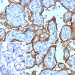 Formalin-fixed, paraffin-embedded human placenta stained with CD168 / HMMR Mouse Monoclonal Antibody (HMMR/8021). Inset: PBS instead of primary antibody; secondary only negative control.