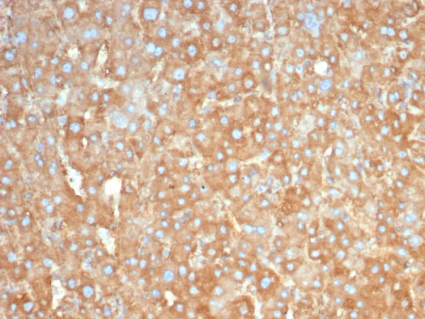 Formalin-fixed, paraffin-embedded human liver stained with Haptoglobin Mouse Monoclonal Antibody (HP/3831). HIER: Tris/EDTA, pH9.0, 45min. 2°C: HRP-polymer, 30min. DAB, 5min.