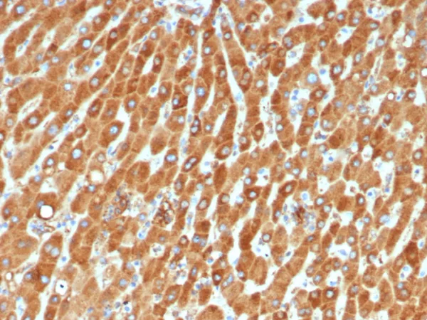 Formalin-fixed, paraffin-embedded human liver stained with Haptoglobin Mouse Monoclonal Antibody (HP/4815). HIER: Tris/EDTA, pH9.0, 45min. 2°C: HRP-polymer, 30min. DAB, 5min.