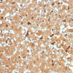 Formalin-fixed, paraffin-embedded human liver stained with Haptoglobin Mouse Monoclonal Antibody (HP/3832). HIER: Tris/EDTA, pH9.0, 45min. 2°C: HRP-polymer, 30min. DAB, 5min.