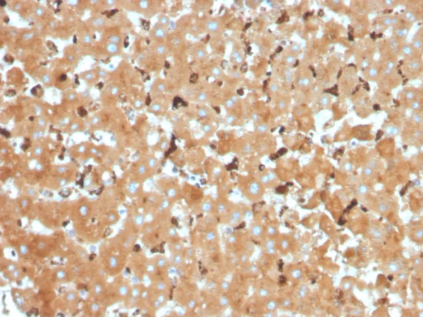 Formalin-fixed, paraffin-embedded human liver stained with Haptoglobin Mouse Monoclonal Antibody (HP/3832). HIER: Tris/EDTA, pH9.0, 45min. 2°C: HRP-polymer, 30min. DAB, 5min.