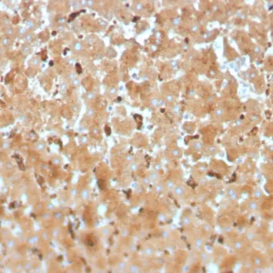 Formalin-fixed, paraffin-embedded human liver stained with Haptoglobin Mouse Monoclonal Antibody (HP/3834). HIER: Tris/EDTA, pH9.0, 45min. 2°C: HRP-polymer, 30min. DAB, 5min.