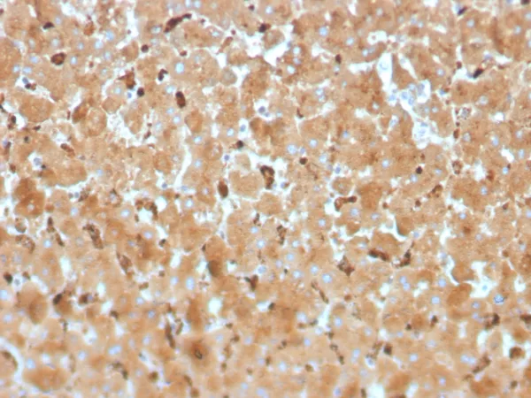 Formalin-fixed, paraffin-embedded human liver stained with Haptoglobin Mouse Monoclonal Antibody (HP/3834). HIER: Tris/EDTA, pH9.0, 45min. 2°C: HRP-polymer, 30min. DAB, 5min.