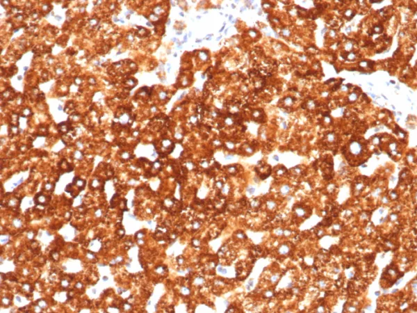 Formalin-fixed, paraffin-embedded human liver stained with Haptoglobin Mouse Monoclonal Antibody (HP/3838). HIER: Tris/EDTA, pH9.0, 45min. 2°C: HRP-polymer, 30min. DAB, 5min.