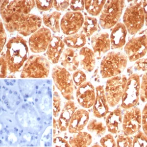 Formalin-fixed, paraffin-embedded human kidney stained with HSPA1A Mouse Monoclonal Antibody (HSPA1A/7932). Inset: PBS instead of primary antibody; secondary only negative control.