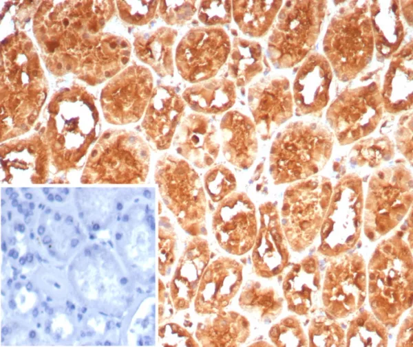 Formalin-fixed, paraffin-embedded human kidney stained with HSPA1A Mouse Monoclonal Antibody (HSPA1A/7932). Inset: PBS instead of primary antibody; secondary only negative control.