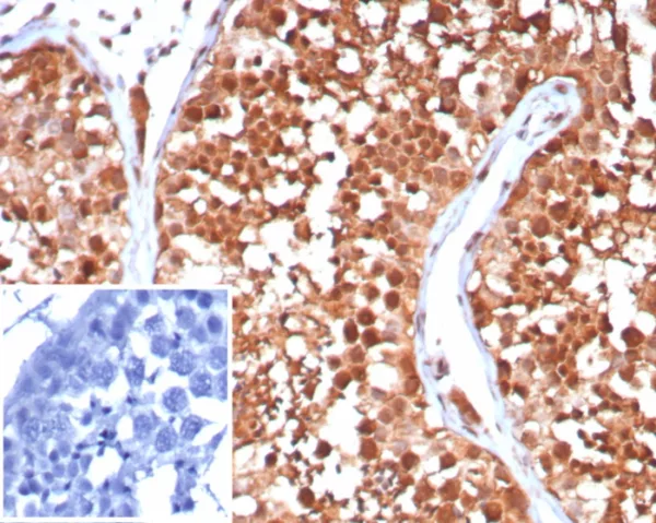 Formalin-fixed, paraffin-embedded human testis stained with HSPA1A Mouse Monoclonal Antibody (HSPA1A/7932). Inset: PBS instead of primary antibody; secondary only negative control.