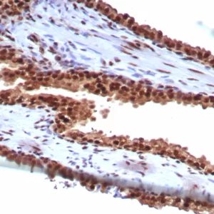 Formalin-fixed, paraffin-embedded human prostate stained with HSPA1B Mouse Monoclonal Antibody (HSPA1B/7629). HIER: Tris/EDTA, pH9.0, 45min. 2: HRP-polymer, 30min. DAB, 5min.