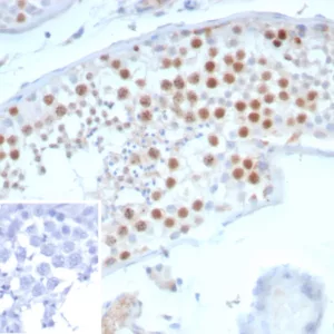 Formalin-fixed, paraffin-embedded human testis stained with Survivin / BIRC5 Mouse Monoclonal Antibody (BIRC5/7775). Inset: PBS instead of primary antibody; secondary only negative control.