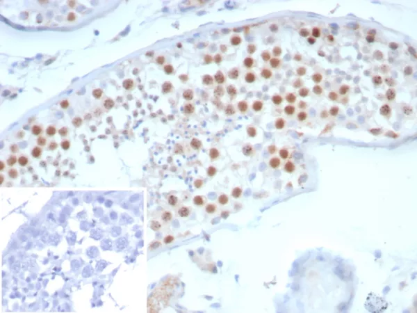 Formalin-fixed, paraffin-embedded human testis stained with Survivin / BIRC5 Mouse Monoclonal Antibody (BIRC5/7775). Inset: PBS instead of primary antibody; secondary only negative control.