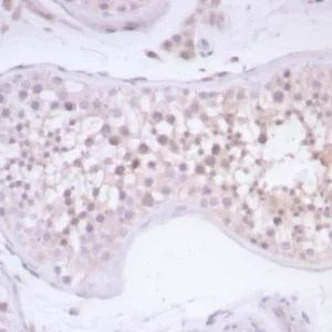 Formalin-fixed, paraffin-embedded human testis stained with Survivin / BIRC5 Mouse Monoclonal Antibody (BIRC5/7778). HIER: Tris/EDTA, pH9.0, 45min. 2°C: HRP-polymer, 30min. DAB, 5min.