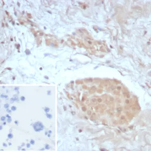 Formalin-fixed, paraffin-embedded human testis stained with Survivin Recombinant Rabbit Monoclonal Antibody (BIRC5/8987R). Inset: PBS instead of primary antibody; secondary only negative control.