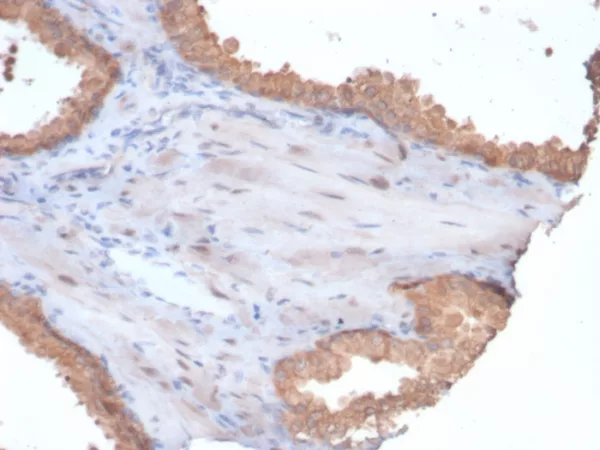 Formalin-fixed, paraffin-embedded human prostate stained with HSP90AA1 Mouse Monoclonal Antibody (HSP90AA1/7247). HIER: Tris/EDTA, pH9.0, 45min. 2°C: HRP-polymer, 30min. DAB, 5min.