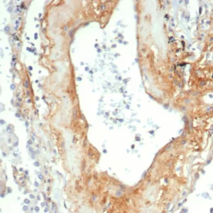 Formalin-fixed, paraffin-embedded human lung stained with Tenascin C Mouse Recombinant Monoclonal Antibody (TNC/4805).