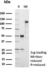 SDS-PAGE Analysis of Purified CD54 Recombinant Rabbit Monoclonal Antibody (ICAM1/9379R). Confirmation of Purity and Integrity of Antibody.
