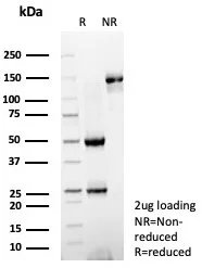 SDS-PAGE Analysis of Purified CD54 Recombinant Rabbit Monoclonal Antibody (ICAM1/8247R). Confirmation of Purity and Integrity of Antibody.
