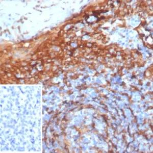 Formalin-fixed, paraffin-embedded human tonsil stained with STING1 Mouse Monoclonal Antibody (STING1/7441). Inset: PBS instead of primary antibody; secondary only negative control.