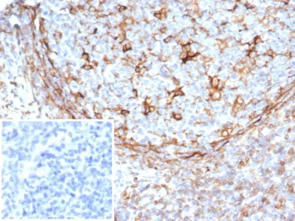 Formalin-fixed, paraffin-embedded human tonsil stained with STING1 Mouse Monoclonal Antibody (STING1/7433). Inset: PBS instead of primary antibody; secondary only negative control.