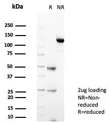 SDS-PAGE Analysis of Purified STING1 Mouse Monoclonal Antibody (STING1/7434). Confirmation of Purity and Integrity of Antibody.