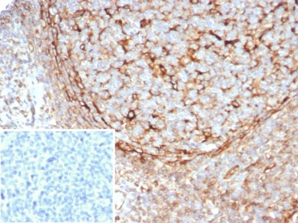 Formalin-fixed, paraffin-embedded human tonsil stained with STING1 Mouse Monoclonal Antibody (STING1/7434). Inset: PBS instead of primary antibody; secondary only negative control.