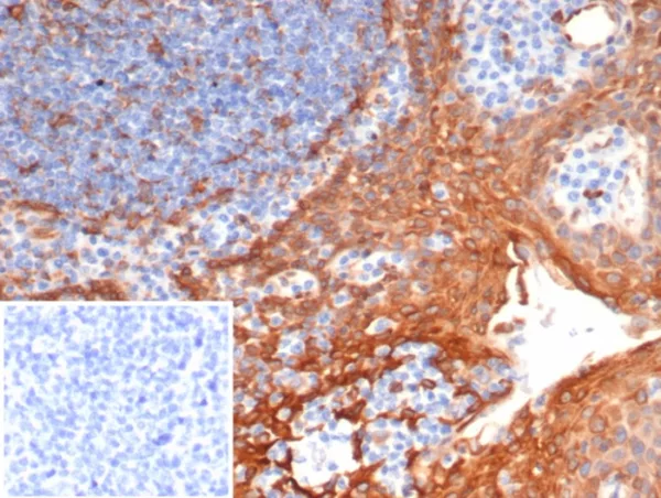 Formalin-fixed, paraffin-embedded human tonsil stained with STING1 Mouse Monoclonal Antibody (STING1/7435). Inset: PBS instead of primary antibody; secondary only negative control.