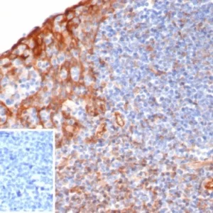 Formalin-fixed, paraffin-embedded human tonsil stained with STING1 Mouse Monoclonal Antibody (STING1/7436). Inset: PBS instead of primary antibody; secondary only negative control.
