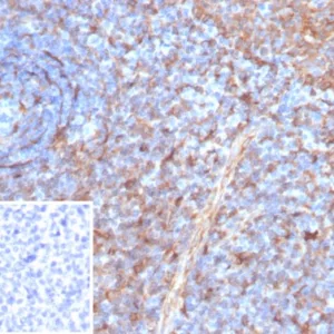 Formalin-fixed, paraffin-embedded human tonsil stained with STING1 Mouse Monoclonal Antibody (STING1/7437). Inset: PBS instead of primary antibody; secondary only negative control.