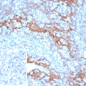 Formalin-fixed, paraffin-embedded human tonsil stained with STING1 Mouse Monoclonal Antibody (STING1/7438). Inset: PBS instead of primary antibody; secondary only negative control.