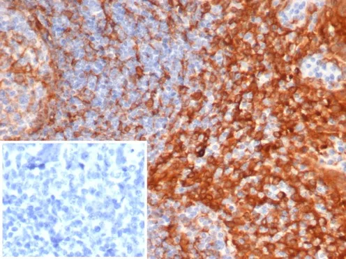 Formalin-fixed, paraffin-embedded human tonsil stained with STING1 Mouse Monoclonal Antibody (STING1/7439). Inset: PBS instead of primary antibody; secondary only negative control. STING1 Antibody in Immunohistochemistry (IHC (P))