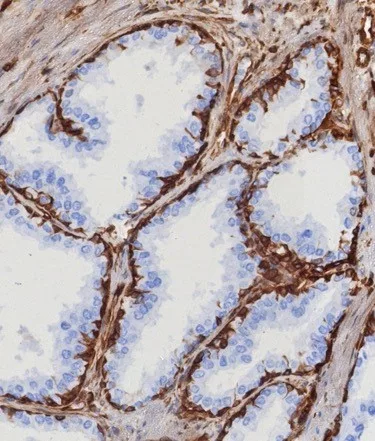 Formalin-fixed, paraffin-embedded human prostate stained with STING1 Mouse Monoclonal Antibody (STING1/7439). HIER: Tris/EDTA, pH9.0, 45min. 2°: HRP-polymer, 30min. DAB, 5min. STING1 Antibody in Immunohistochemistry (IHC (P))