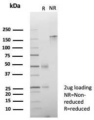 SDS-PAGE Analysis. Purified ZNF774 Mouse Monoclonal Antibody (PCRP-ZNF774-3F7).  Confirmation of Purity and Integrity of Antibody.