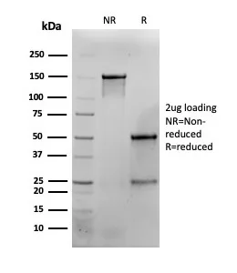 SDS-PAGE Analysis of Purified IFNG Mouse Monoclonal Antibody (G-23).                        Confirmation of Purity and Integrity of Antibody.