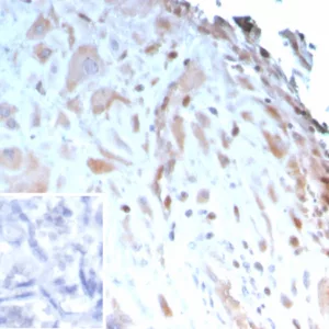 Formalin-fixed, paraffin-embedded human placenta stained with IGFBP3 Mouse Monoclonal Antibody (IGFBP3/3423). Inset: PBS instead of primary antibody; secondary only negative control.