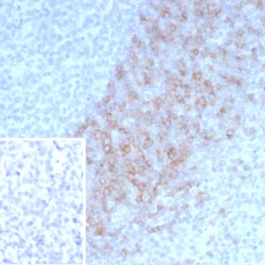 Formalin-fixed, paraffin-embedded human lymph node stained with IgD Mouse Monoclonal Antibody (IGHD/4967). HIER: Tris/EDTA, pH9.0, 45min. 2°C: HRP-polymer, 30min. DAB, 5min.