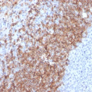 Formalin-fixed, paraffin-embedded human tonsil stained with IgD Recombinant Rabbit Monoclonal Antibody (IGHD/2730R). HIER: Tris/EDTA, pH9.0, 45min. 2°C: HRP-polymer, 30min. DAB, 5min.