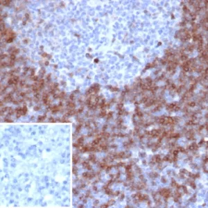 Formalin-fixed, paraffin-embedded human lymph node stained with IgD Recombinant Rabbit Monoclonal Antibody (IGHD/6818R). Inset: PBS instead of primary antibody; secondary only negative control.