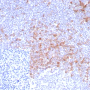 Formalin-fixed, paraffin-embedded human tonsil stained with IgD Recombinant Rabbit Monoclonal Antibody (IGHD/8228R). Inset: PBS instead of primary antibody; secondary only negative control.