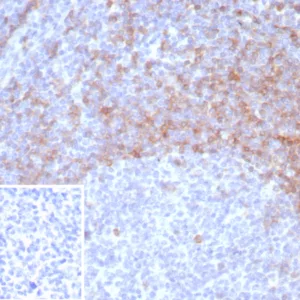 Formalin-fixed, paraffin-embedded human tonsil stained with IgD Recombinant Rabbit Monoclonal Antibody (IGHD/8326R). Inset: PBS instead of primary antibody; secondary only negative control.