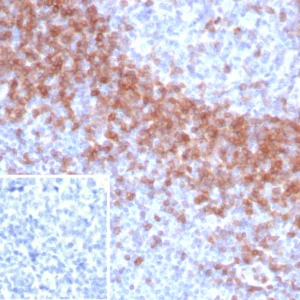 Formalin-fixed, paraffin-embedded human tonsil stained with IgD Recombinant Rabbit Monoclonal Antibody (IGHD/8367R). Inset: PBS instead of primary antibody; secondary only negative control.