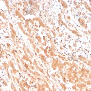 Formalin-fixed, paraffin-embedded human liver stained with Apolipoprotein H Mouse Monoclonal Antibody (APOH/3682). HIER: Tris/EDTA, pH9.0, 45min. 2°C: HRP-polymer, 30min. DAB, 5min.