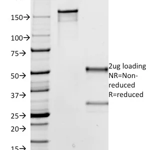 SDS-PAGE Analysis of Purified IgG Mouse Monoclonal Antibody (IG266). Confirmation of Integrity and Purity of Antibody.